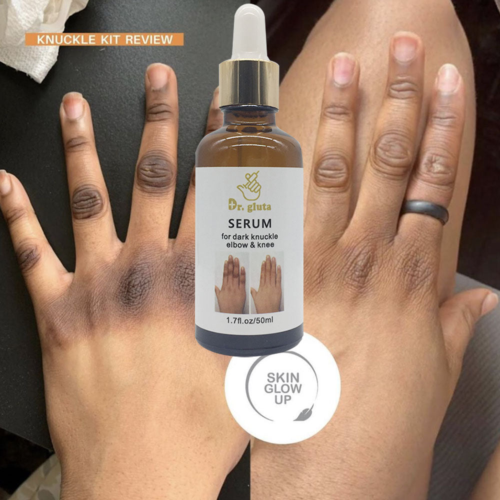 Dr. gluta Whitening knuckles Serum Hand knuckle Erase Serum For