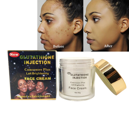 Glutathion Injection Whitening Face Cream